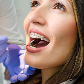 Closeup of beautiful girl with dental braces check up