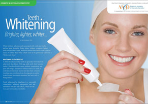 Teeth Whitening – Brighter, lighter, whiter