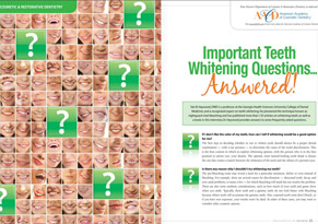 Important Teeth Whitening Questions Answered!
