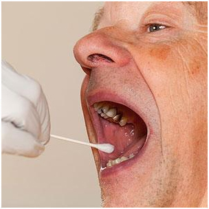New Saliva Test may Help Identify Oral Cancer Earlier