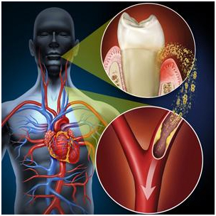 The Health of Your Mouth Could Affect the Rest of Your Body