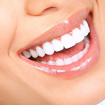Six Month Smiles for fast, effective teeth straightening
