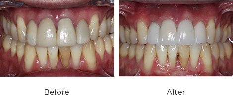 before-after-2