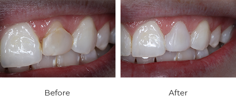 before-after-8