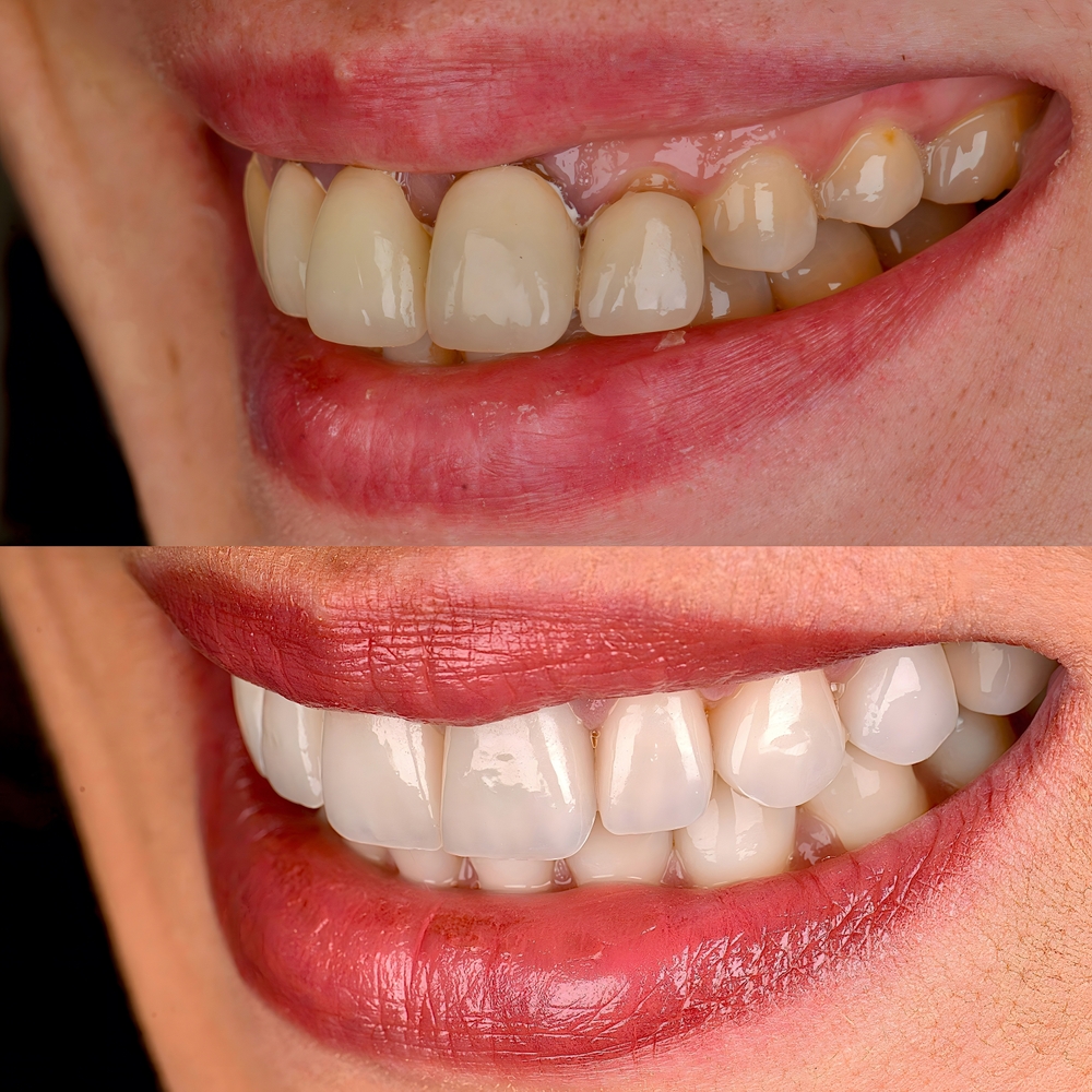 restorative dentistry cedar hills